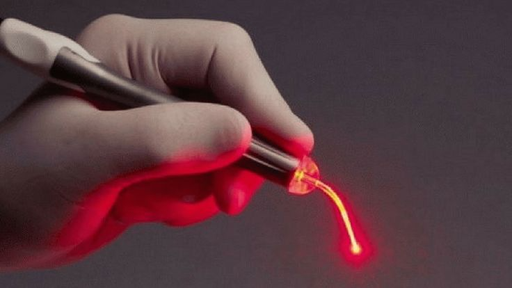 Os benefícios da laserterapia na odontologia moderna