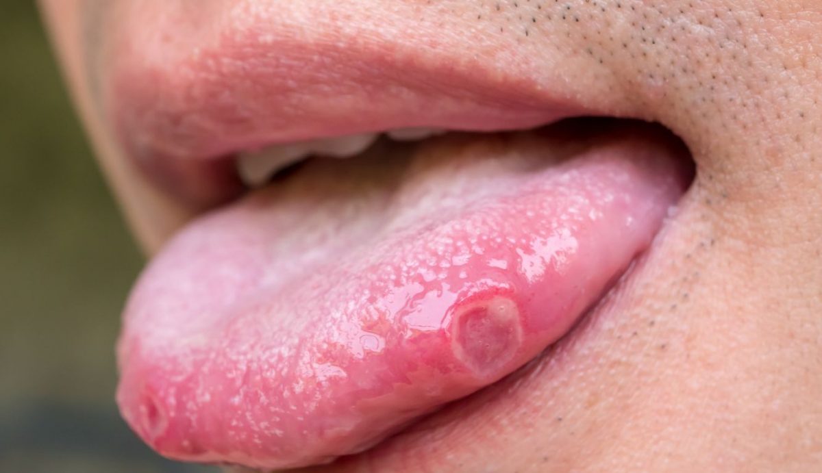 Estomatologia em silêncio: Por que ainda falamos pouco sobre saúde bucal sistêmica?